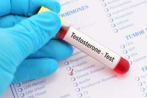 Testosateron-test