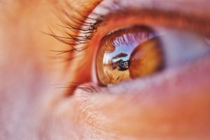Augenleiden-Makuladegeneration