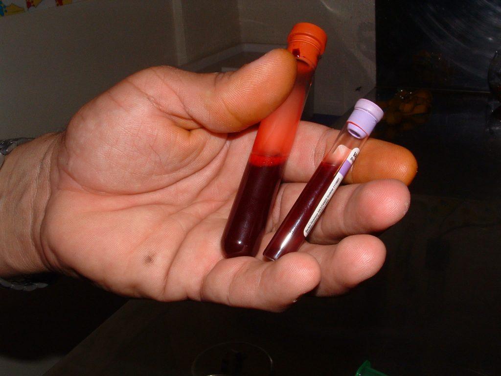 Ernährungsmedizin-Mikronährstoffmedizin